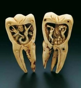 Relationship of Tooth Worm and Dental Plaques